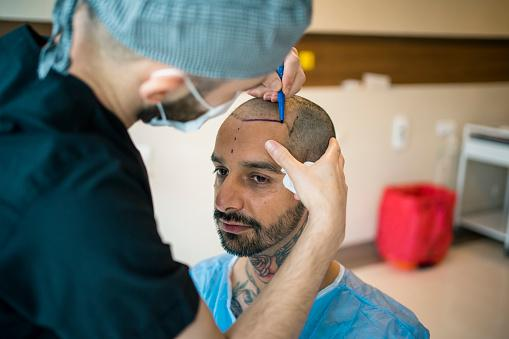 How to Find The Best Hair Transplant Clinic in India?