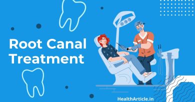 Root Canal Treatment steps