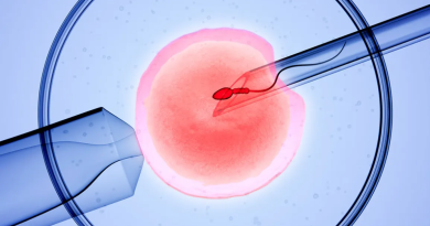 ivf treatment in Udaipur