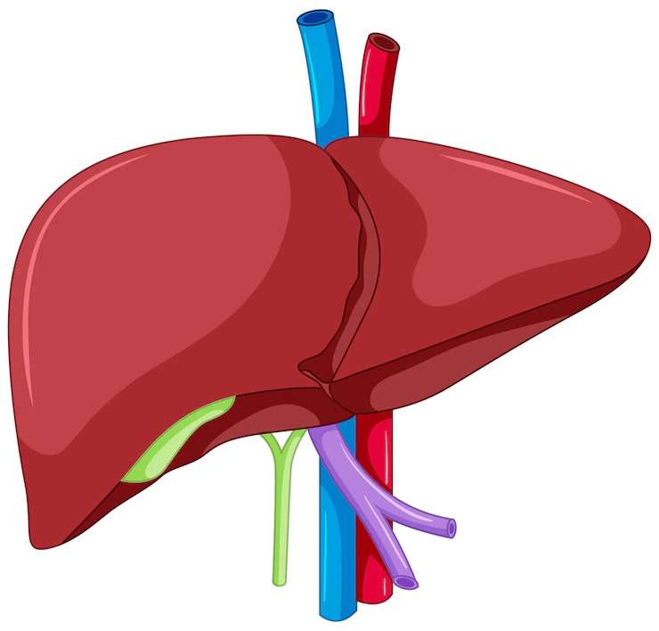 What is the most significant complication of a liver transplant?