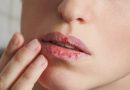 Top Remedies For Dry Lips In Winters