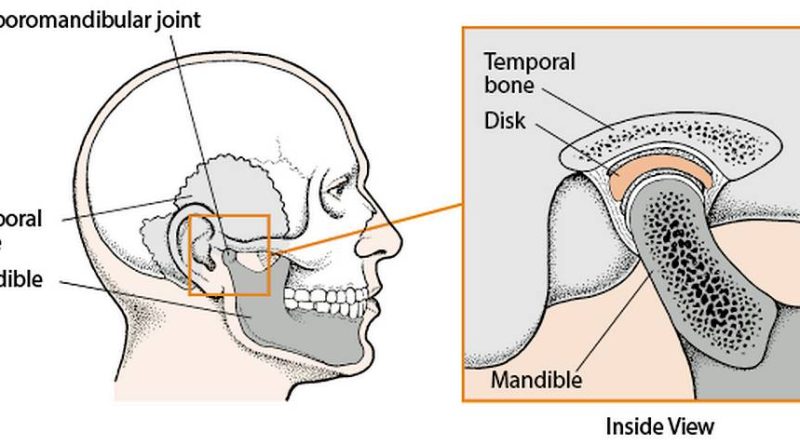 TMJ Treatment