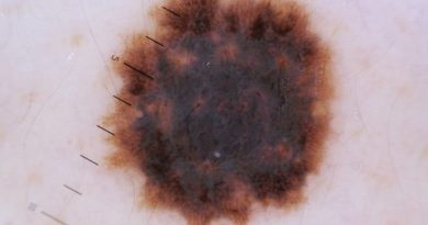 dermatologist Irvine CA