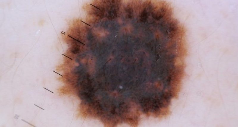 dermatologist Irvine CA